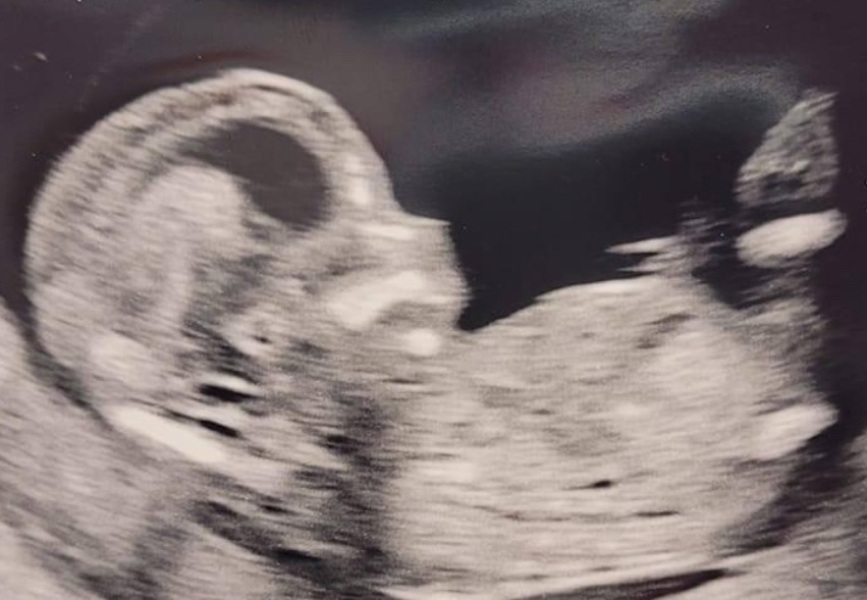 Gender guesses please!