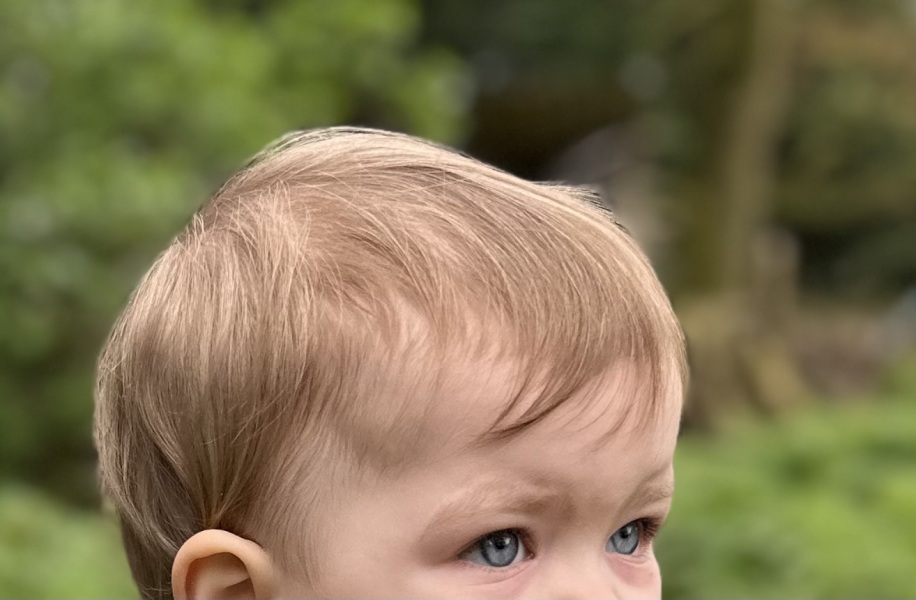 Is this normal development?