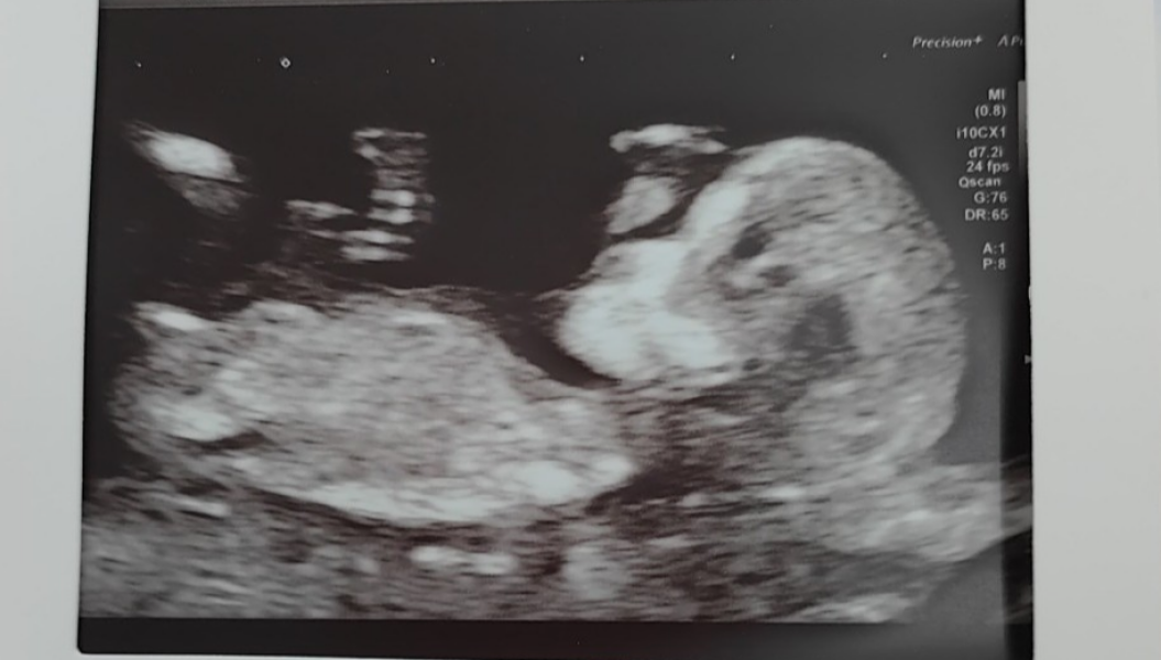 Girl or boy guesses