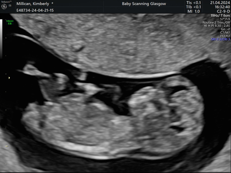 Anyone want me to take a look at their nubs?