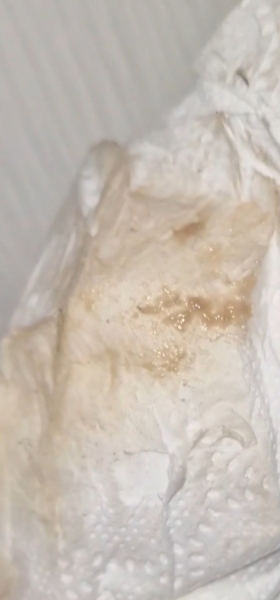 9wks pregnant pink/brown discharge and period symptoms