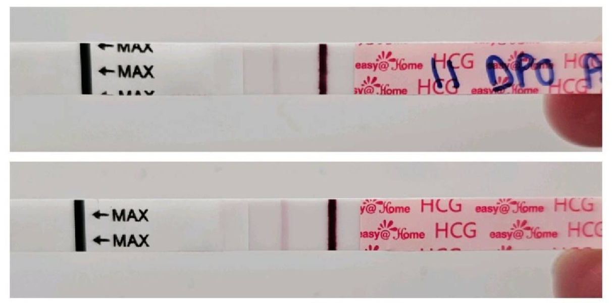 Pregnancy test darker in afternoon is that normal?