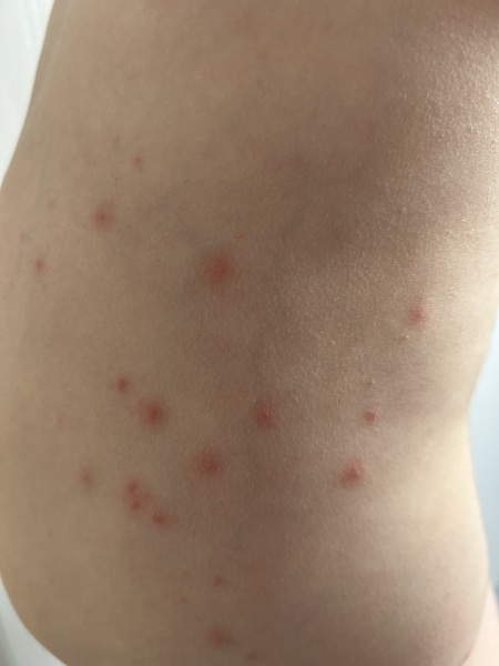 What are these spots?