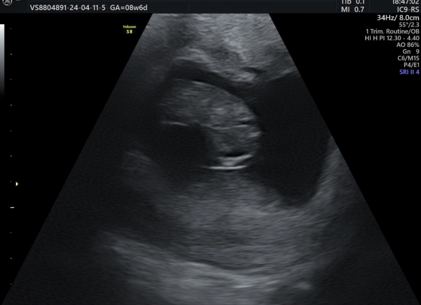 November 2024 Babies - thread 3
