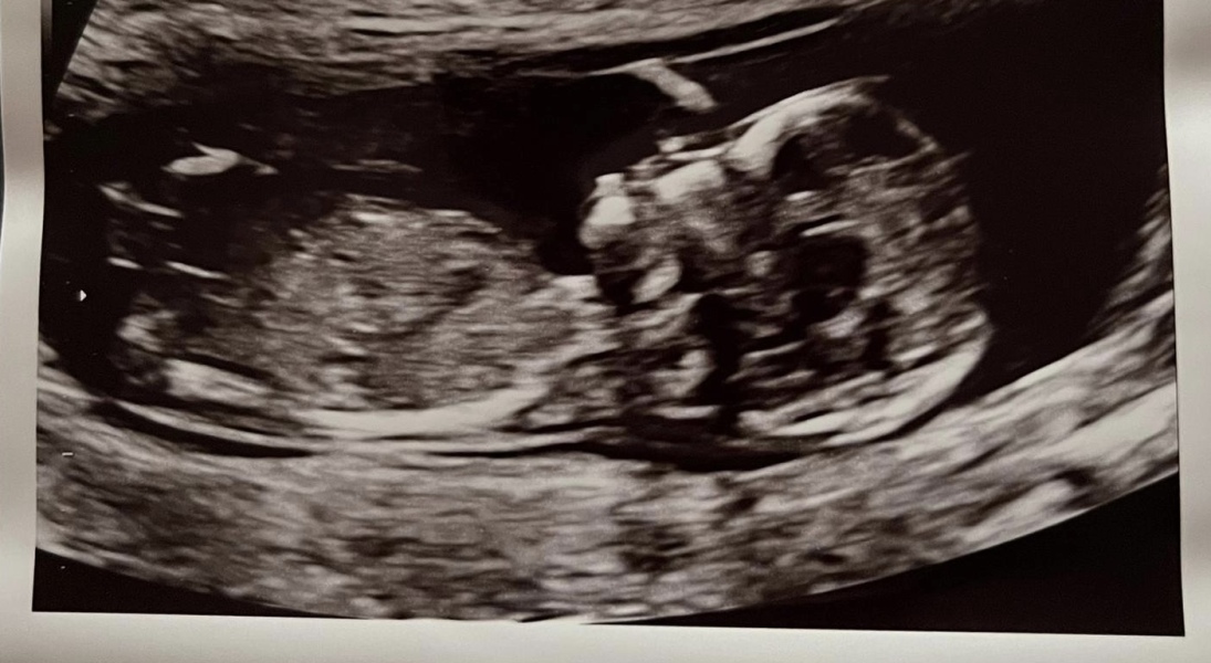 Due September - Thread 5! 🐣❤️🧡💛