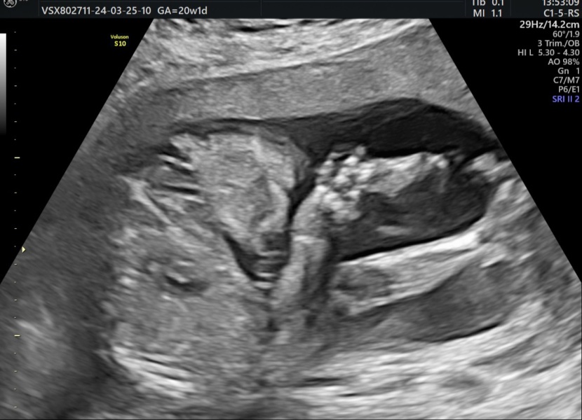 Gender Guesses please?