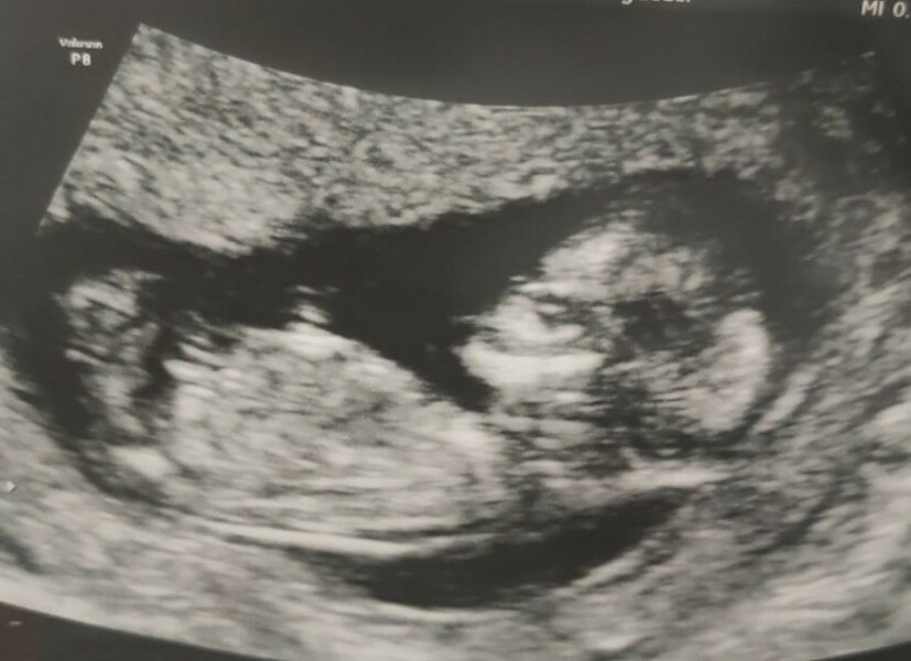 Gender predictions please