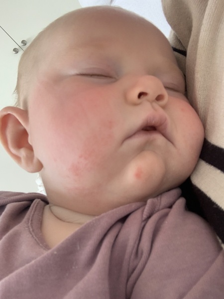 Can anyone help? Baby rash