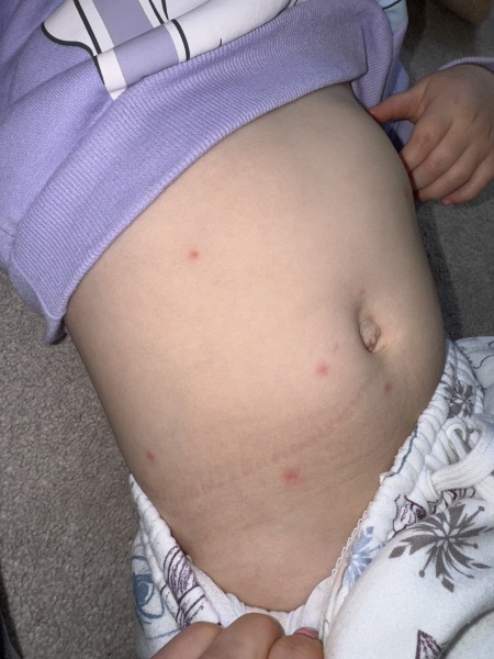 Spots toddler