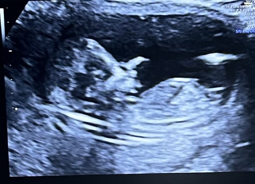 Gender guesses please?