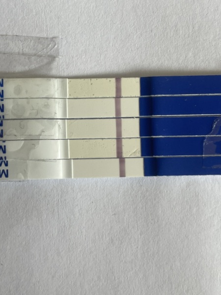 10 dptrigger, tests negative, am I out?