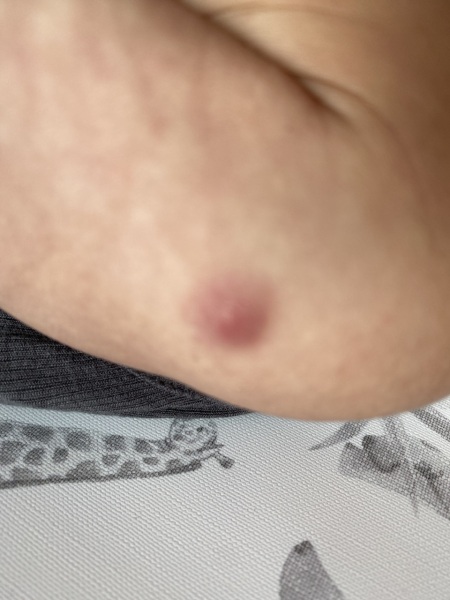 What is this??