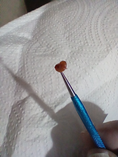 If you ignored an ingrown hair for years, would it look like this?