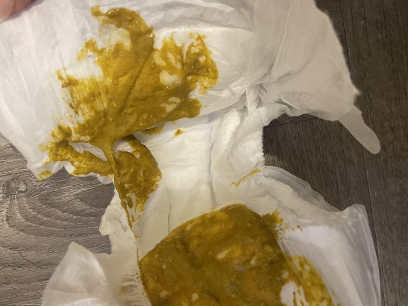 Vinegary/fishy mucus poo, Could this be CMPA? Gross Pic included