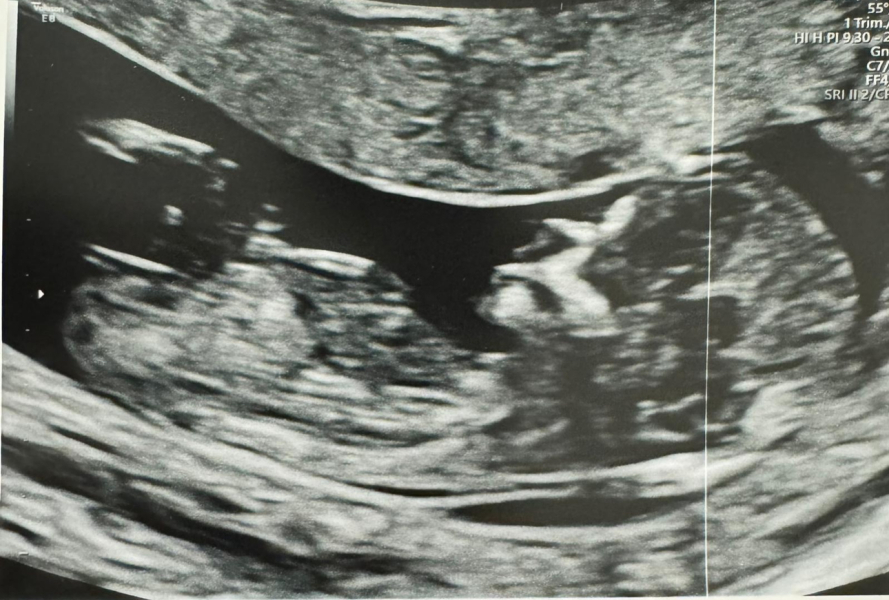 OCTOBER 2024 BABIES - Thread 4