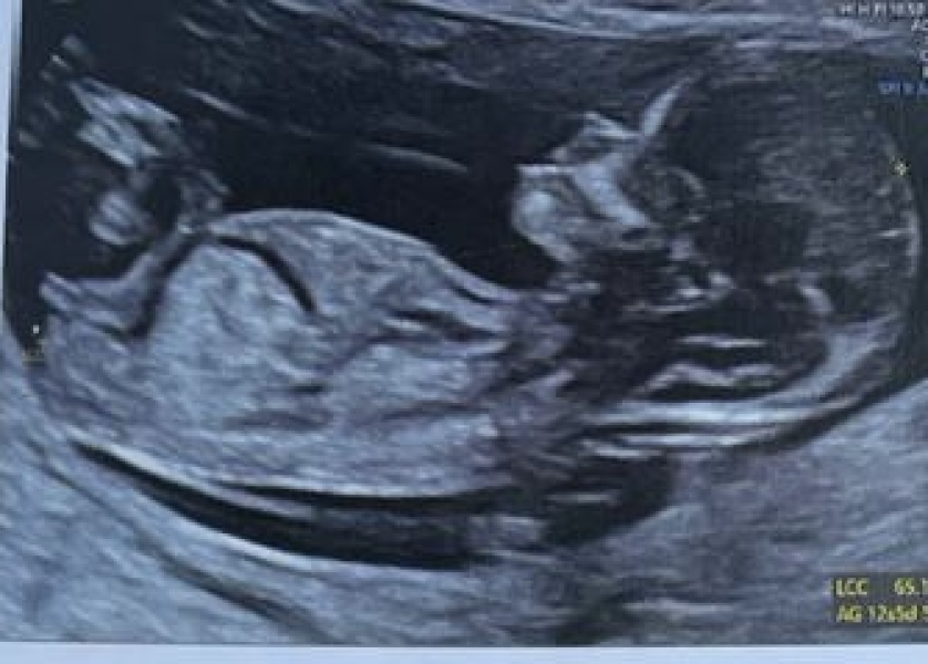Boy or girl nub theory?? Xxxxx