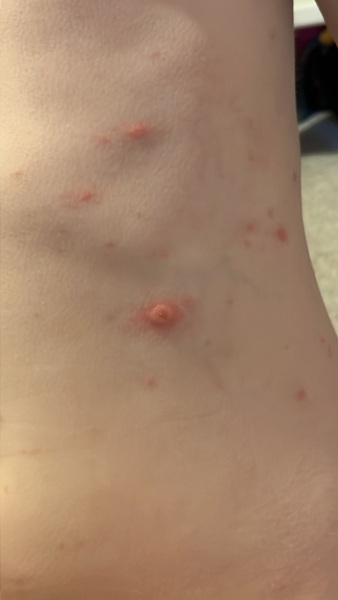 To think this is infected?
