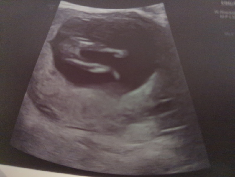 Boy or girl?