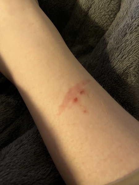 Does this look like it needs a GP appointment?