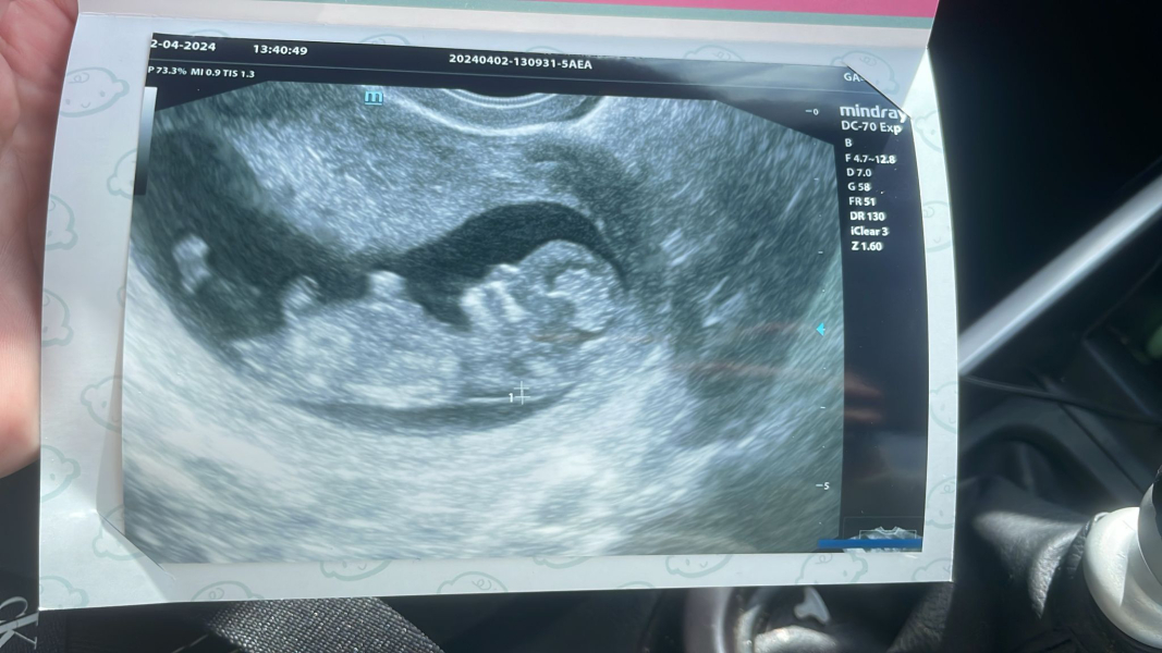 OCTOBER 2024 BABIES :) THREAD 3