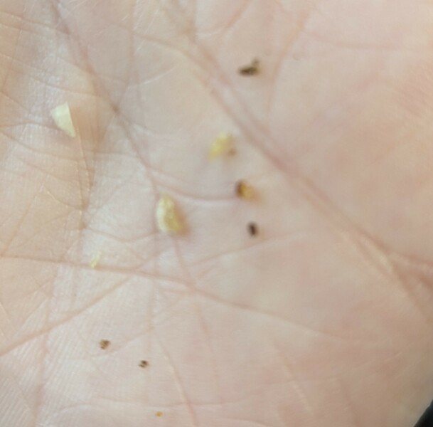 What is this???