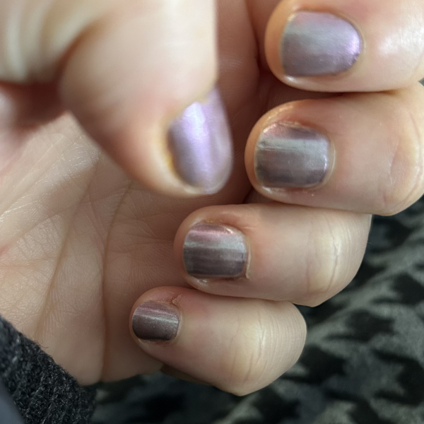 Nail biting - advice please