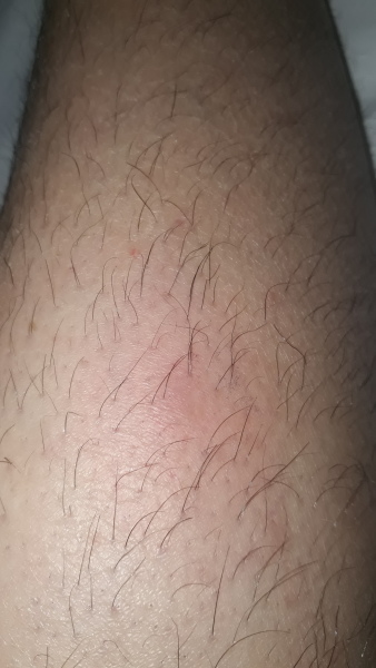 Daughter with hairy legs