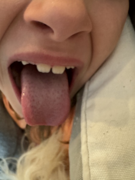 Daily headaches 7 year old