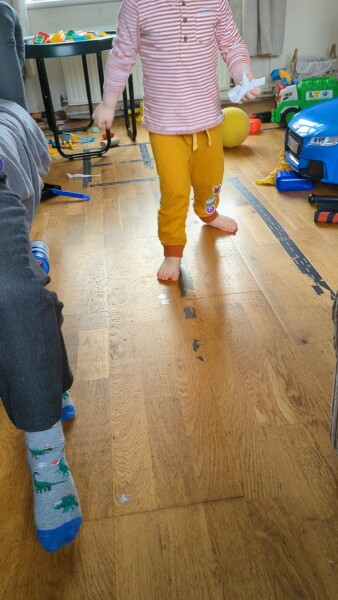 Toddler suddenly turning foot out