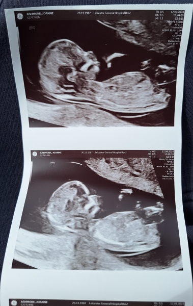 OCTOBER 2024 BABIES :) THREAD 3