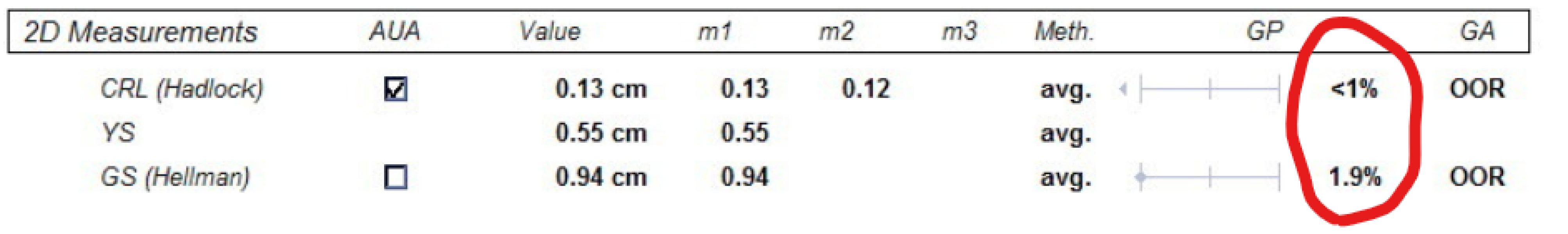 Pregnancy after loss support