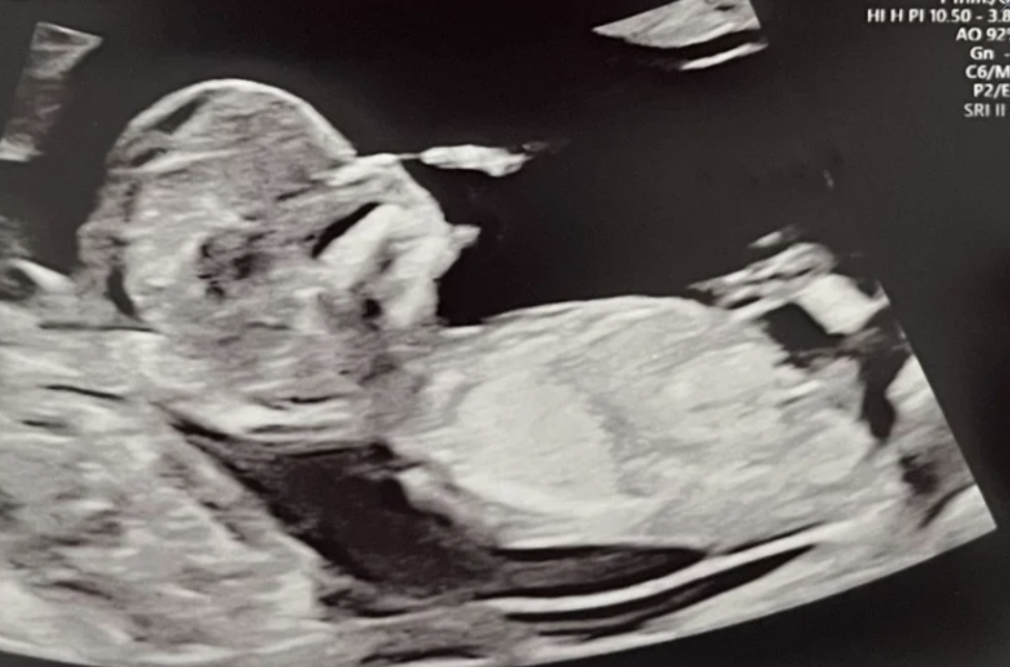 NUB THEORY guess the gender - I will update in 3 weeks!