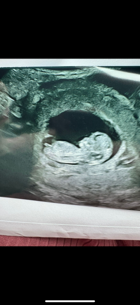Boy Or Girl