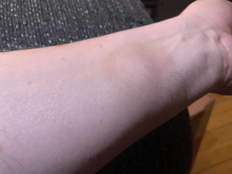 To ask medical people to look at this …