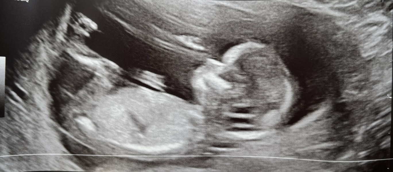 OCTOBER 2024 BABIES :) THREAD 3