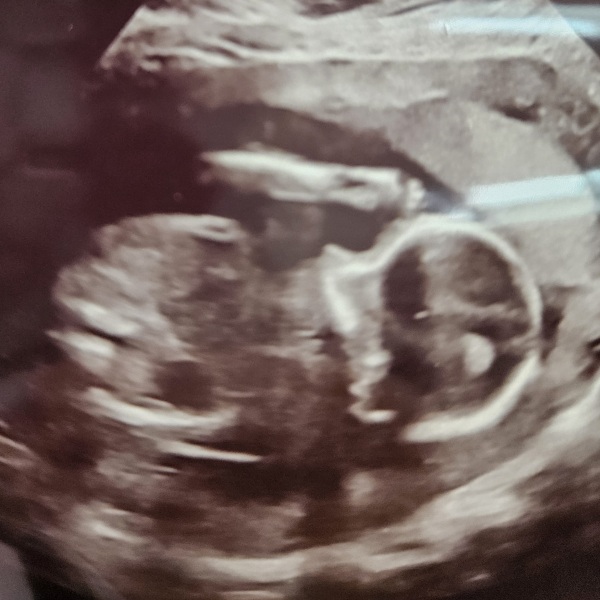 Baby gender. Confused by scan.
