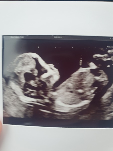 Anyone want me to take a look at their nubs?