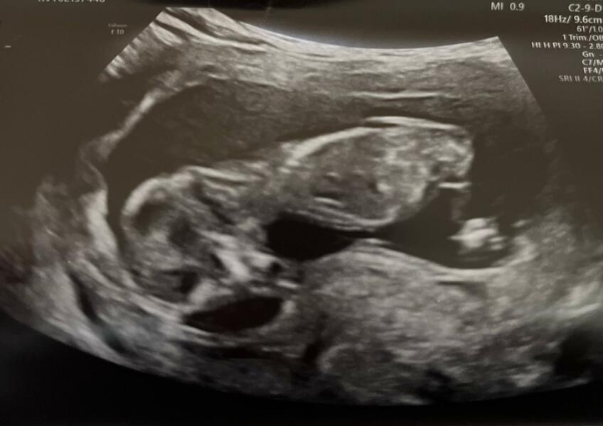 OCTOBER 2024 BABIES :) THREAD 3