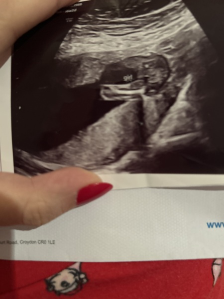 Ultrasound at 16w - can it be wrong