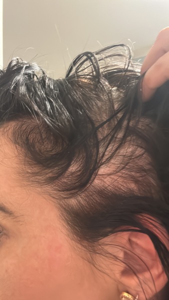 Looking for knowledge on skin cancer