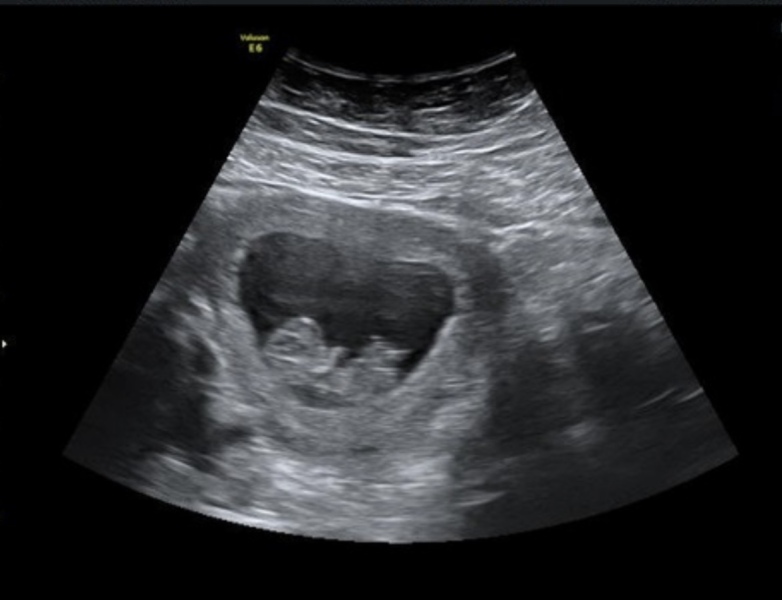 November 2024 Babies- Part 2!