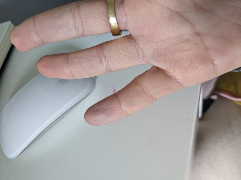 My fingers in my right hand have gone numb...