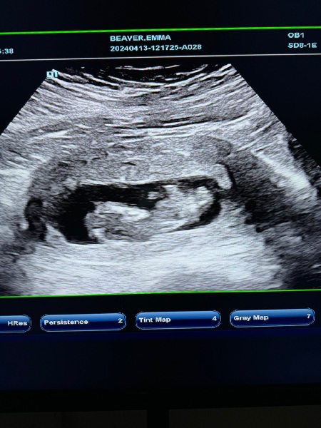 OCTOBER 2024 BABIES :) THREAD 3