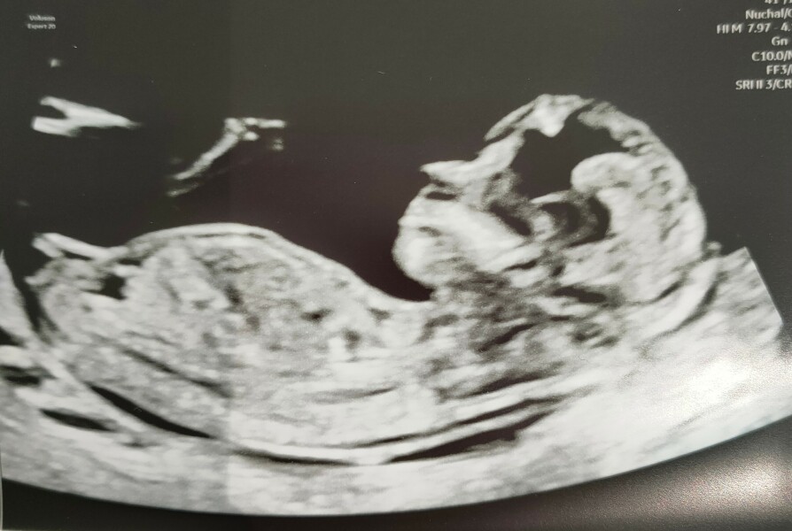 OCTOBER 2024 BABIES - Thread 4