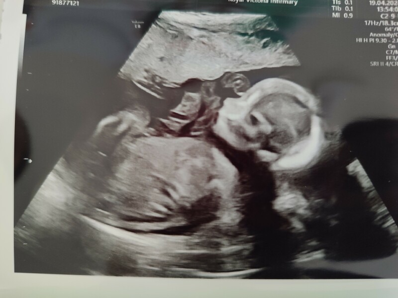 September 2024 - Thread 6! 🐣🧡💛❤️