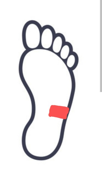 Lump under foot