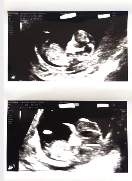 Skull / Nub Theory?! Boy or a girl? HELP! 😃