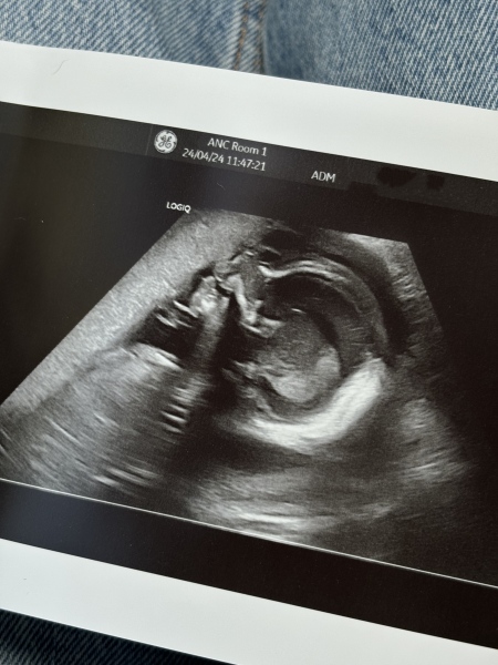 September 2024 - Thread 6! 🐣🧡💛❤️