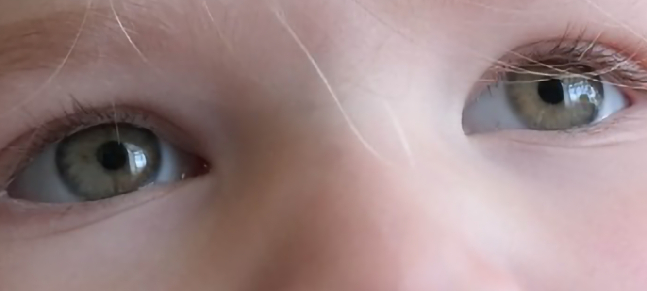 Eye colour, what would you say this is?