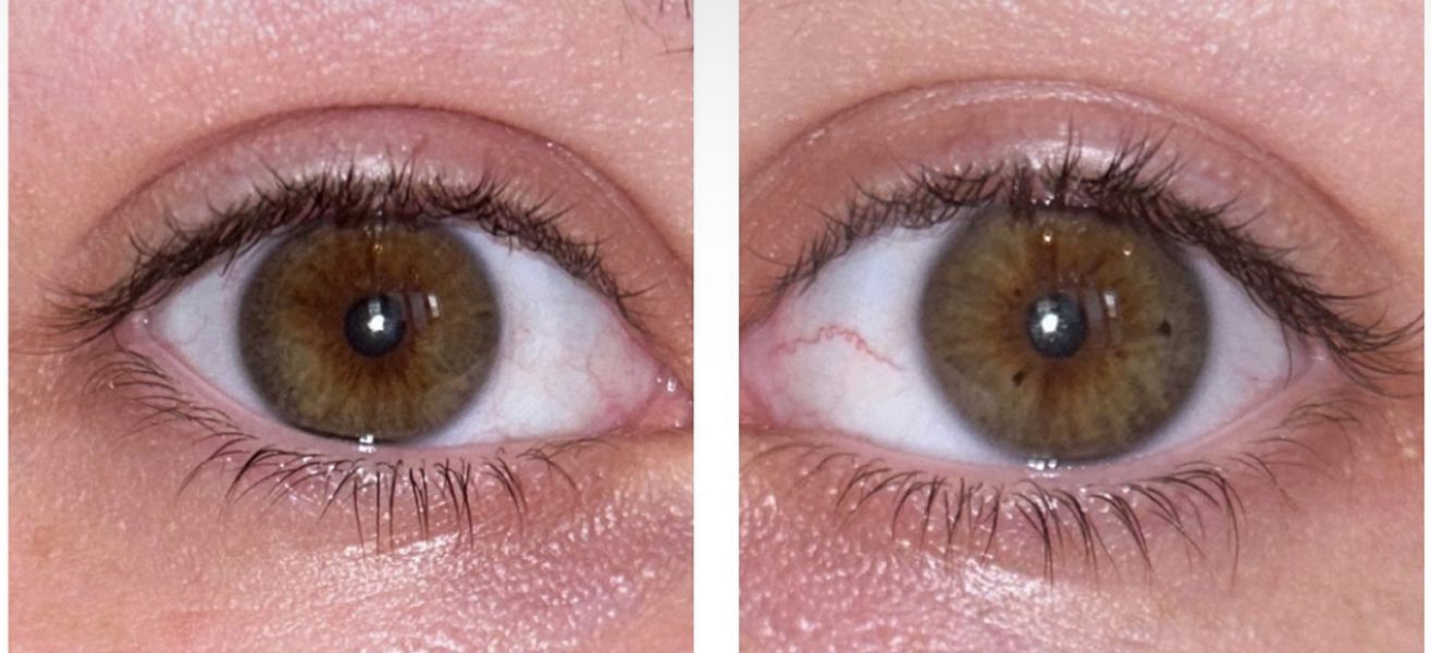 Eye colour help?